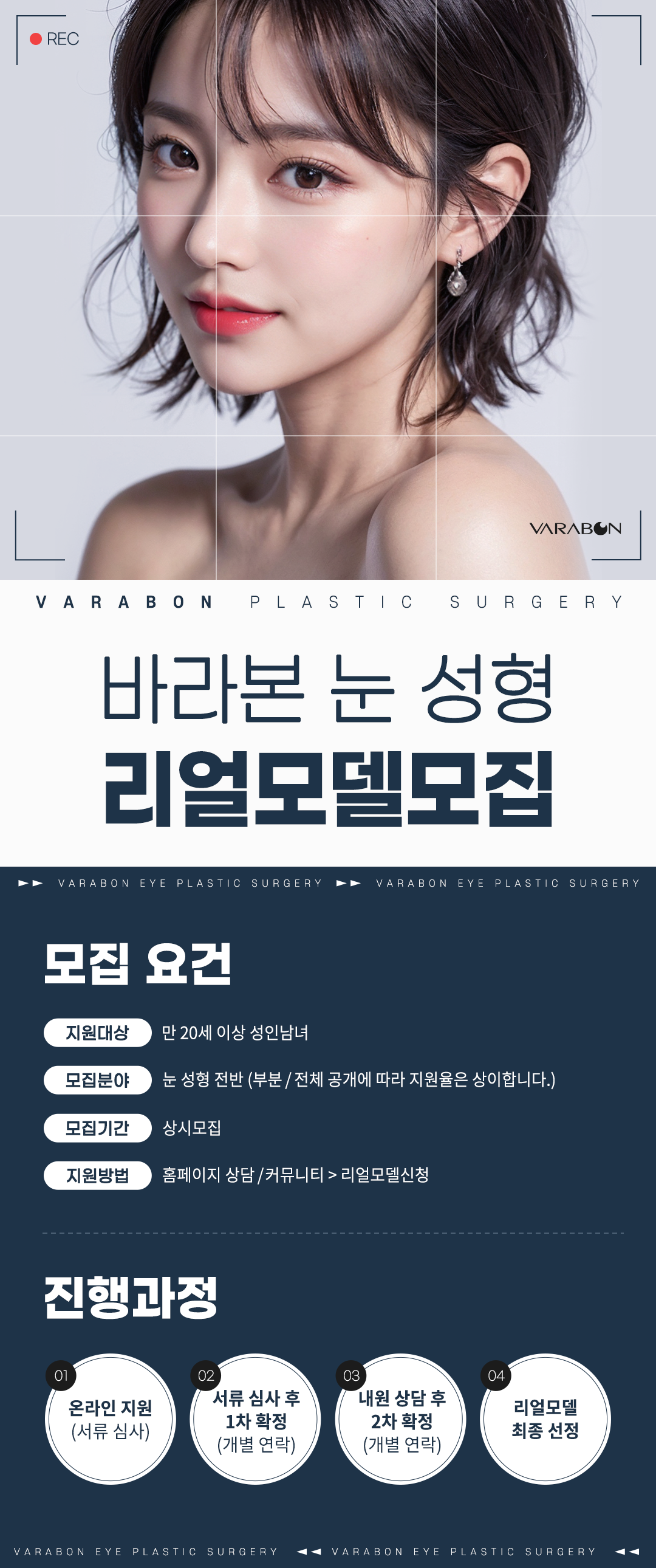 바라본 눈 성형 리얼모델 모집